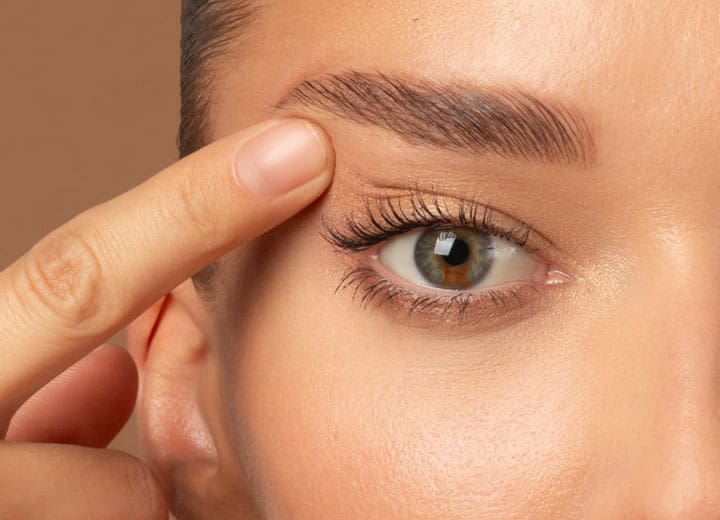 eyebag removal
