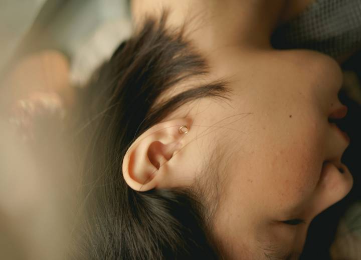 Ear Pinning London